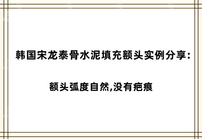 韩国宋龙泰医生骨水泥填充额头实例