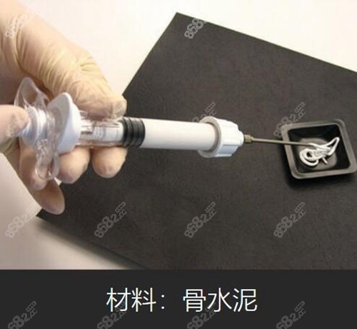 韩国雕刻整形外科医院宋龙泰技术可靠吗？