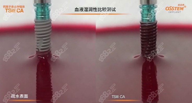 亲水种植牙骨结合程度更好