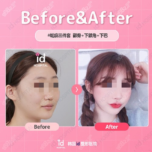 李知赫院长轮廓三件套实例8682.cc