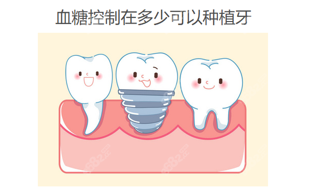 血糖控制在多少可以种植牙
