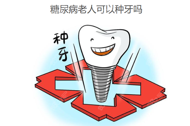 糖尿病老人可以种牙吗