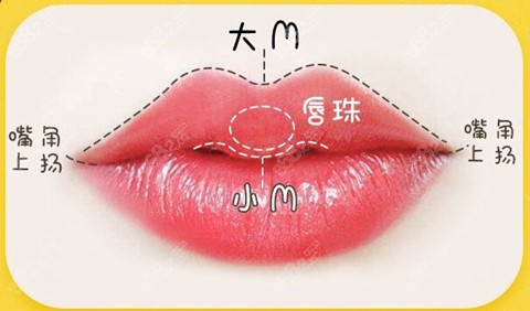 李炫直做嘴巴整形手术技术图