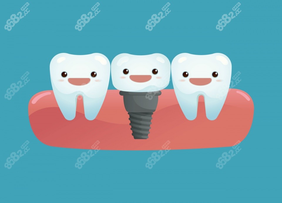 种植牙集采价格2980元起