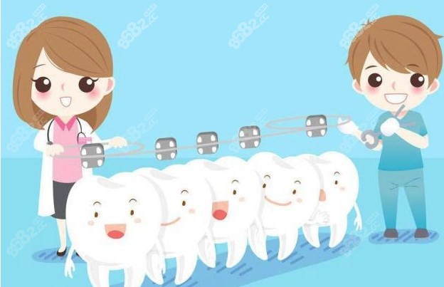 托槽正畸图片