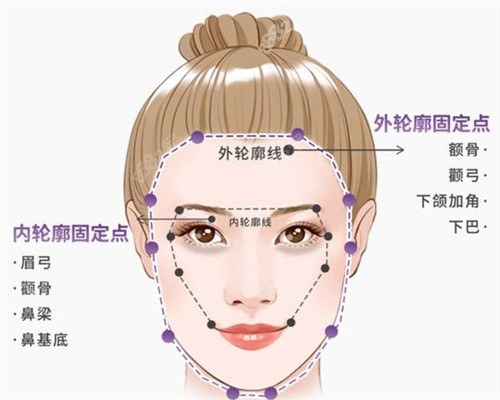 幼态脸轮廓固定手术价格是多少