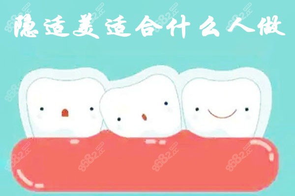 隐适美适合什么人做