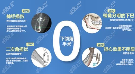 下颌角切除手术价格多少钱m.8682.cc
