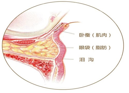 真皮卧蚕填充的位置