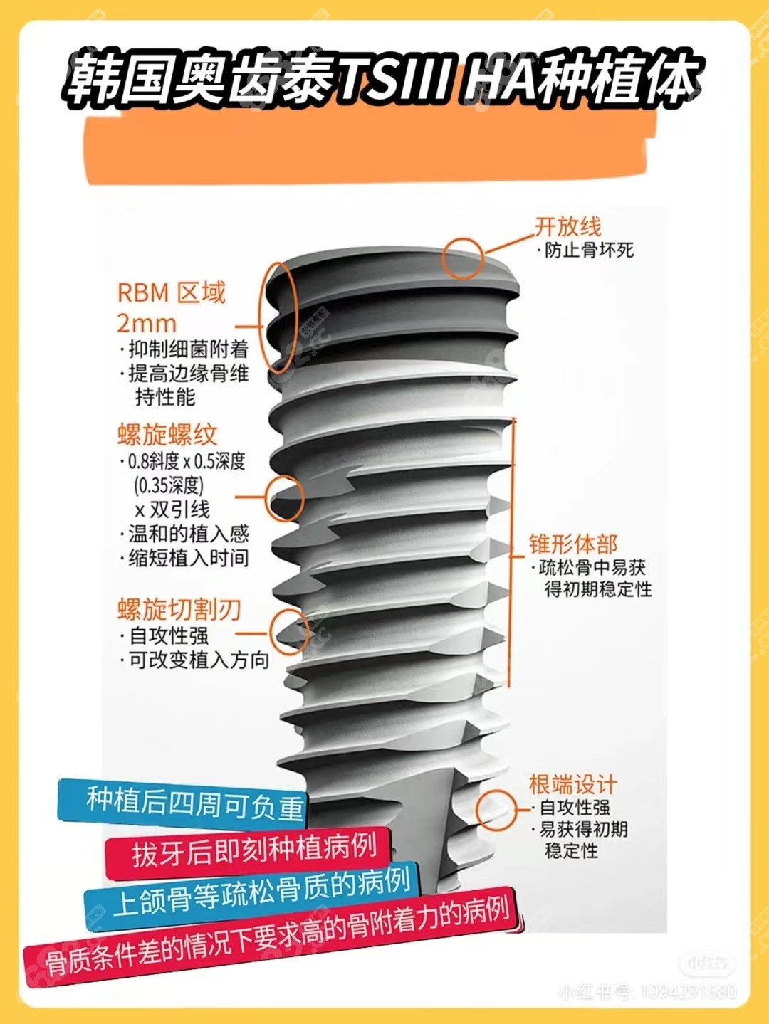 韩国奥齿泰种植牙寿命