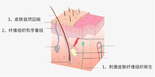 深圳曹孟君医疗美容吸脂塑形