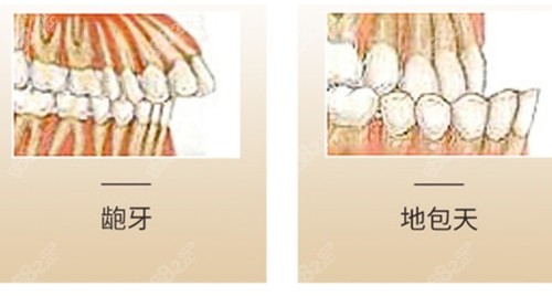 外科正牙手术是骗局
