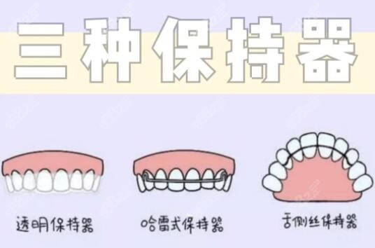 牙齿保持器种类