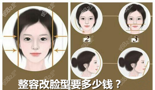 整容改脸型多少钱