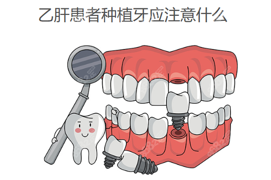 乙肝患者种植牙应注意什么