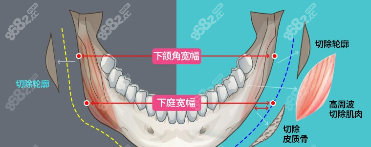 张笑天磨骨技术怎么样