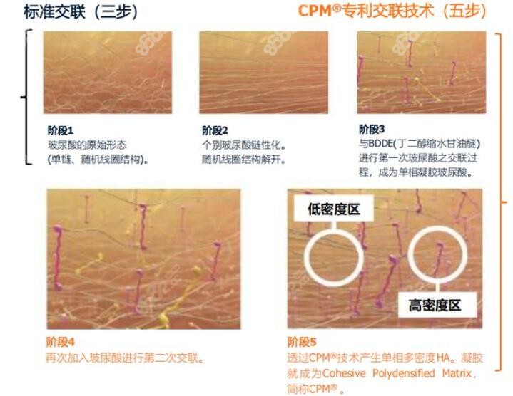 保柔缇玻尿酸核心技术图解