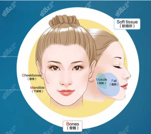 张笑天颧骨内推怎么样？