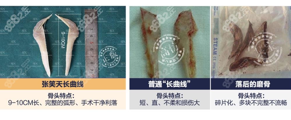 张笑天特点