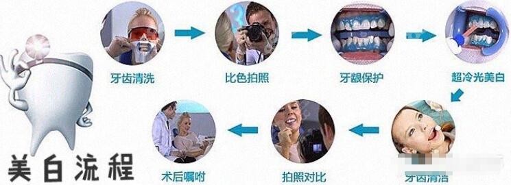 牙齿美白的流程