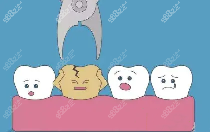 为什么牙医总喜欢劝人拔智齿www.8682.cc