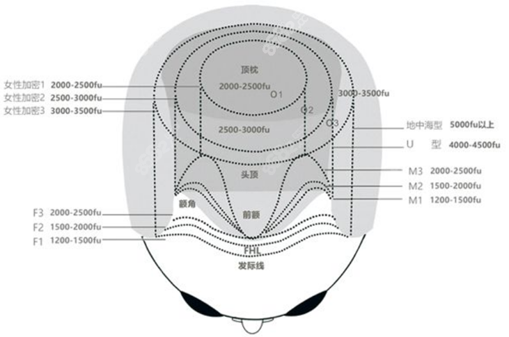 脱发面积成效图8682.cc