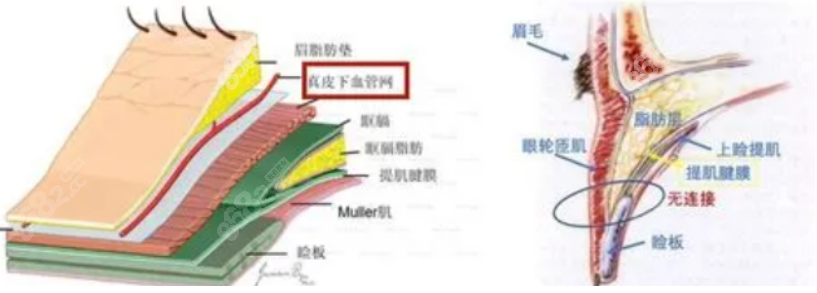 双眼皮修复手术