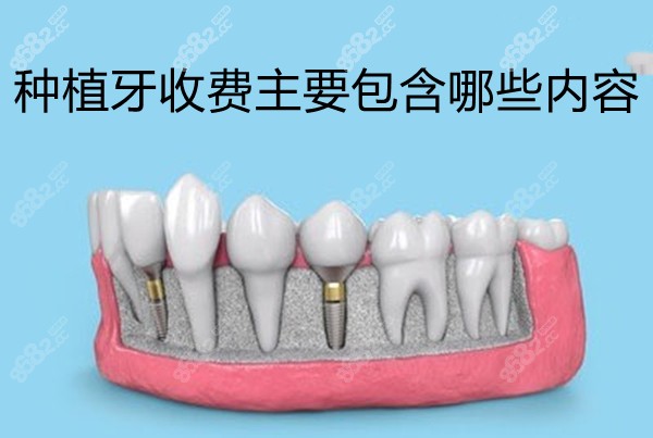 种植牙收费主要包含哪些内容
