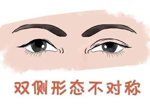 北京丽星翼美眼修复中心价目表中包含魏志香双眼皮修复价格www.8682.cc