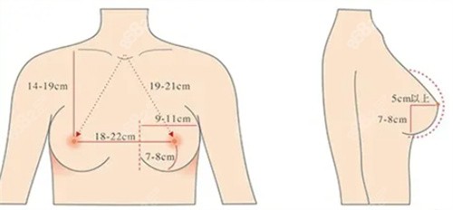 四川<!--<i data=20240705-sp></i>-->紫馨医学美容医院艾剑英隆胸价格参考