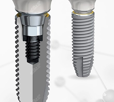 植体的螺纹