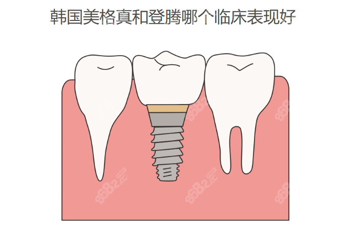 韩国美格真和登腾哪个临床表现好www.8682.cc