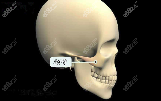 西安颧骨整形哪个医生做的好www.8682.cc