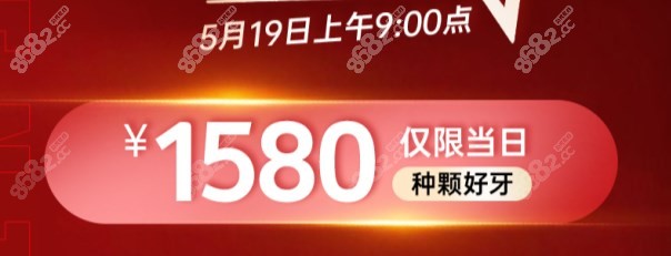 杭州雅莱齿科种植牙当日活动