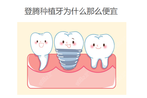 登腾种植牙为什么那么便宜