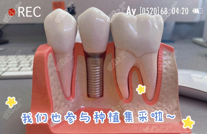 中诺口腔医院种植牙多少钱一颗2023价格表