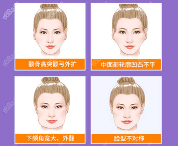 磨骨三件套适合人群有哪些 8682网