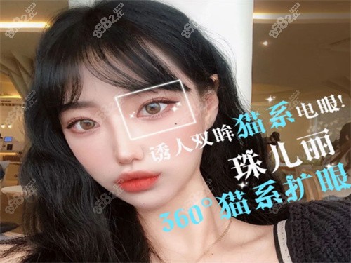 全脸改造实例