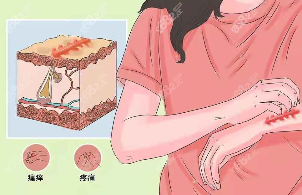 廣州去疤痕增生好的醫(yī)院是哪家www.sorencai.cn