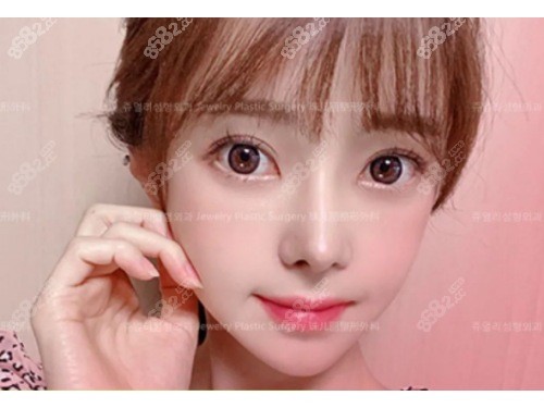 幼态脸全脸整形图片