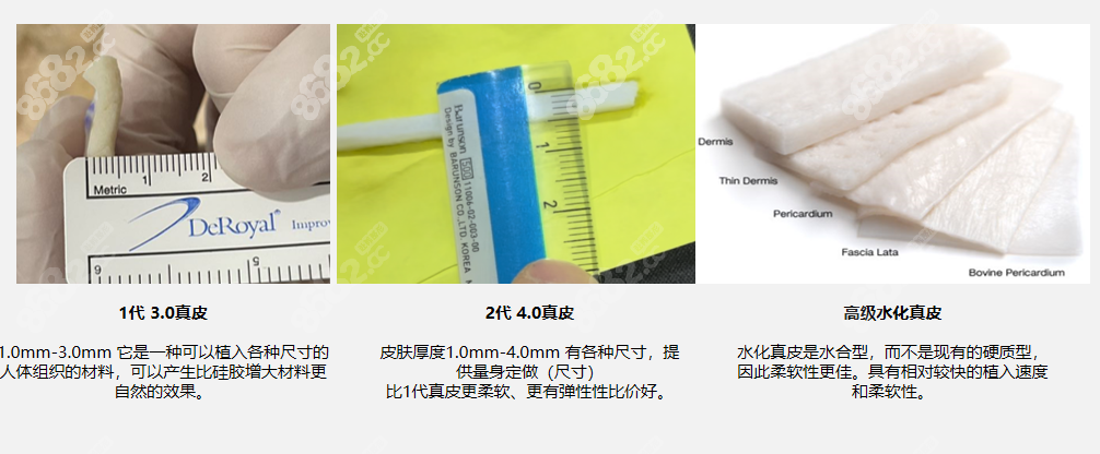 韓國(guó)世檀塔真皮補(bǔ)片增粗使用的真皮材料