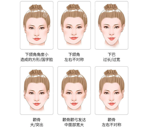 北京磨骨口碑前三的好医院