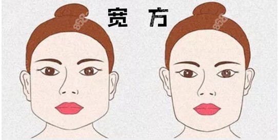 何照华磨骨多少钱www.8682.cc