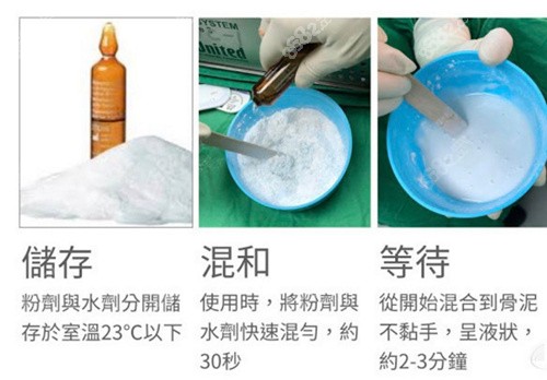 韩国雕刻医院做骨水泥填充材料