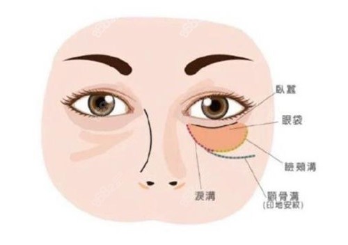 眼周状态图片