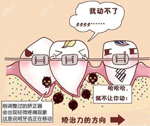 牙齿做矫正疼吗m.8682.cc