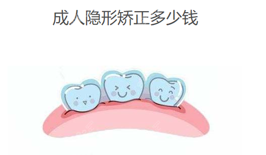 成人牙齿矫正多少钱价格表2025年隐形矫正14000+钢丝牙套5000(图2)