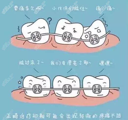 牙齿矫正疼怎么办