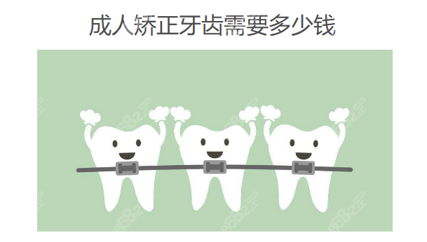 成人牙齿矫正多少钱价格表2025年隐形矫正14000+钢丝牙套5000(图3)