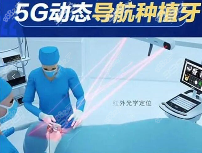 数字化5g动态导航种牙图示8682.cc